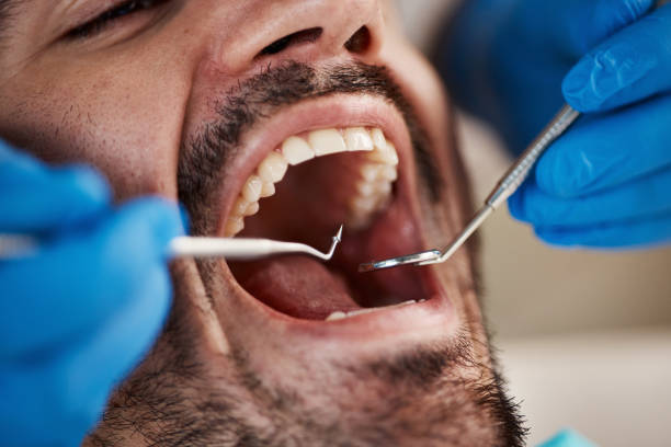 Best Emergency Treatment for Dental Infections or Abscesses in Moses Lake North, WA